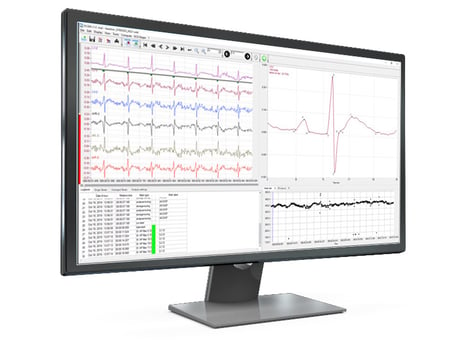 ECG-Median-screen-1