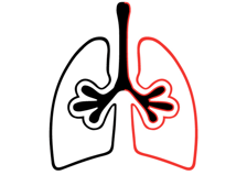 Asthma+overview